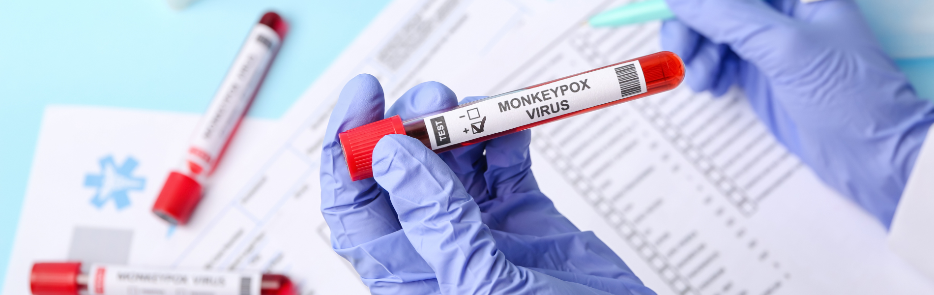 What you need to know about monkeypox - Mayo Clinic Health System