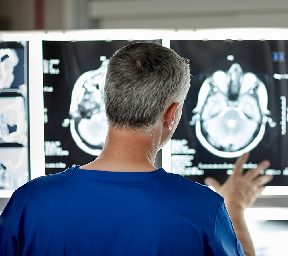Brain MRI