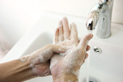 Monkeypox